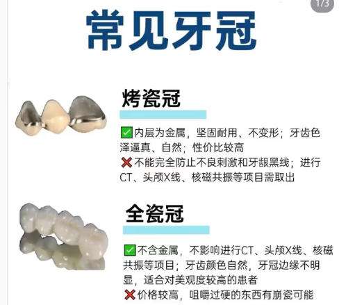 烤瓷牙