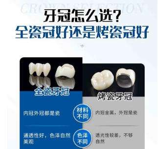 全瓷牙 全瓷牙