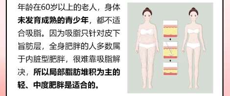 吸脂