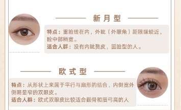 双眼皮 双眼皮