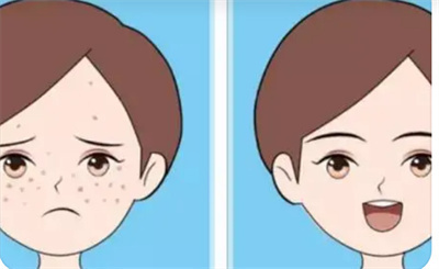 成都素美医院口碑怎么样?附价格表一览,真人案例分享