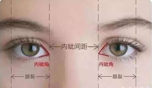 面部 双眼皮 眼睛 吸脂 (11).jpg