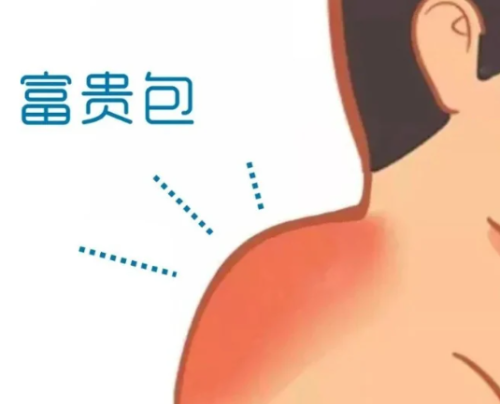 富贵包2.png