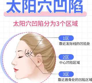 丰太阳穴 丰太阳穴