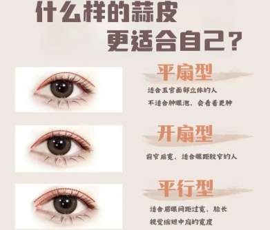 双眼皮 双眼皮