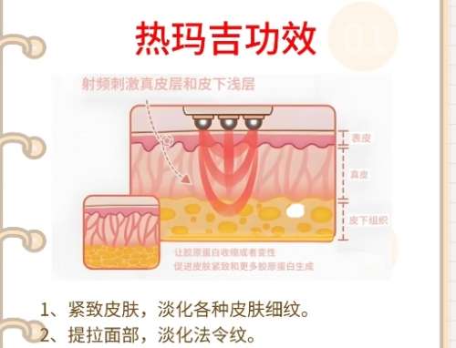 热玛吉