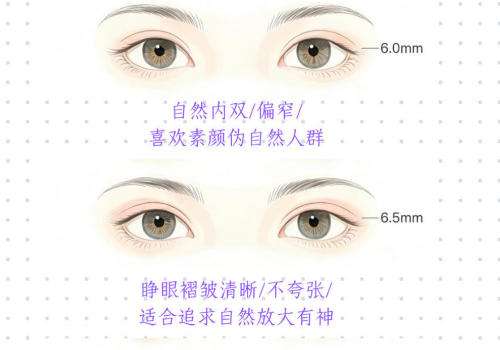 双眼皮 1.jpg 双眼皮 1.jpg