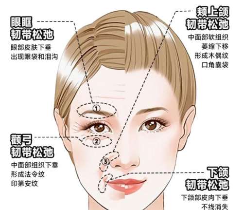 面部提升