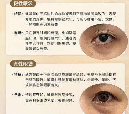 去眼袋