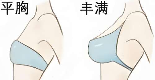 隆胸