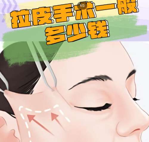 拉皮