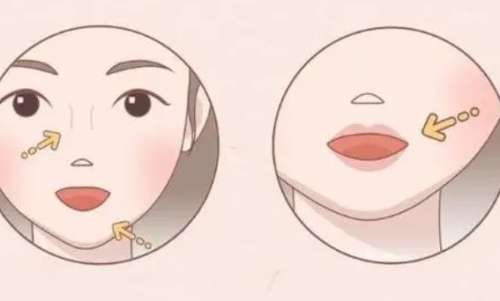 丰唇