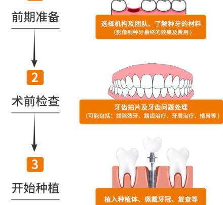 牙齿种植