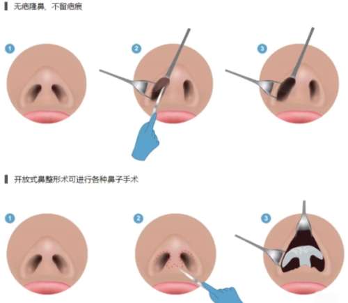 鼻子