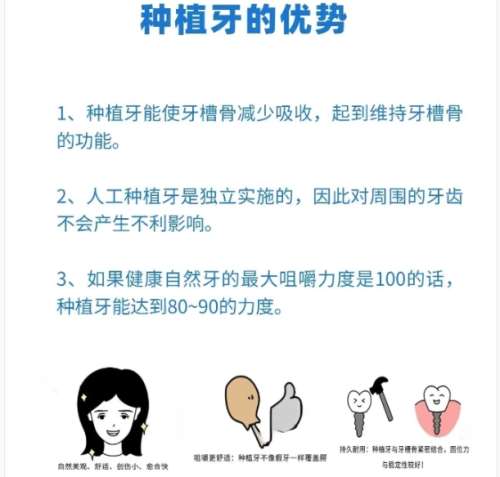 牙齿种植 牙齿种植