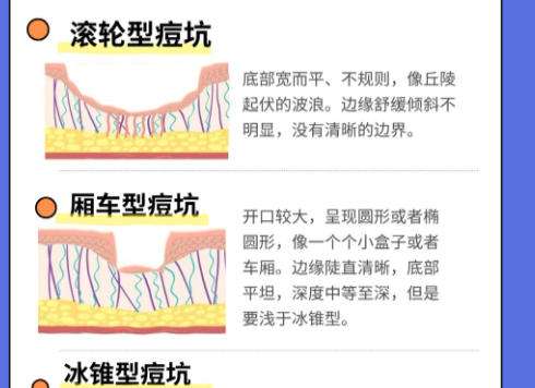 点阵激光2.jpg 点阵激光2.jpg
