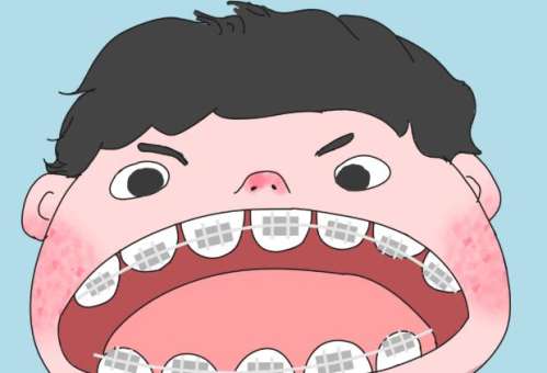 正畸7.jpg