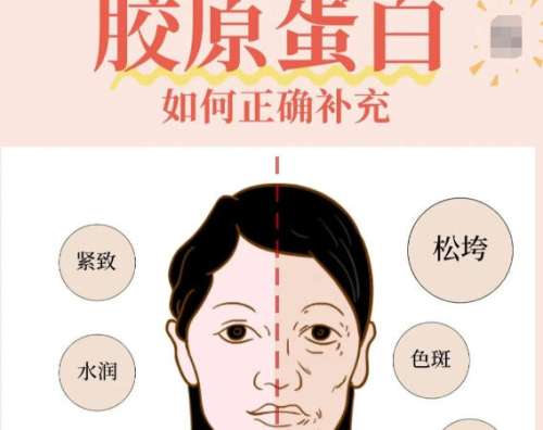 注射胶原蛋白 注射胶原蛋白