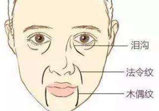 悬吊除皱动漫图01.jpg 悬吊除皱动漫图01.jpg