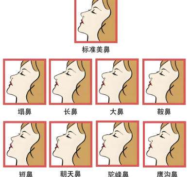鼻子