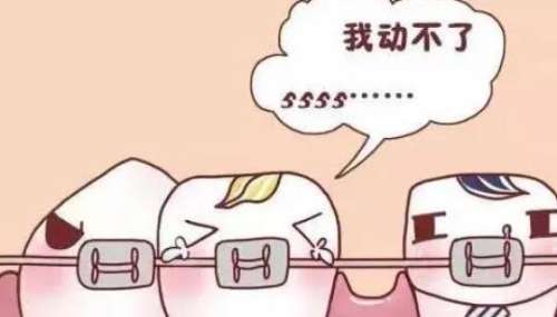 牙齿矫正 牙齿矫正