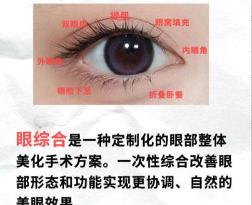 眼综合.jpg 眼综合.jpg