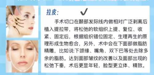 拉皮 拉皮