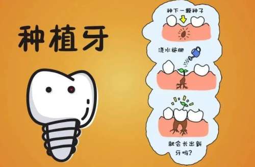 种植牙动漫01.jpg