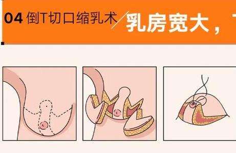 巨乳缩小动漫01.jpg