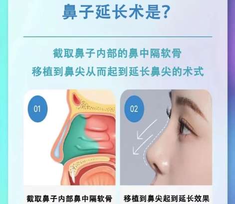 鼻子