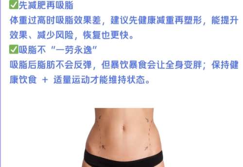 吸脂塑形