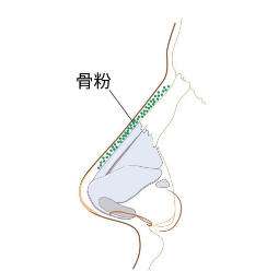 鼻子