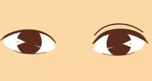 双眼皮16.jpg 双眼皮16.jpg