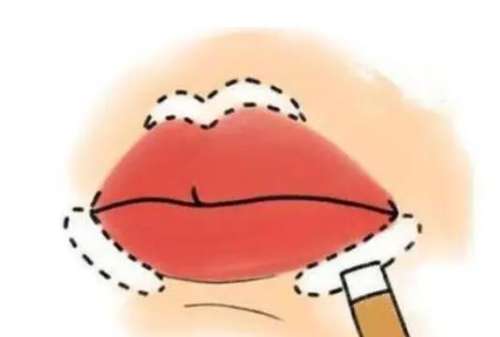 厚唇