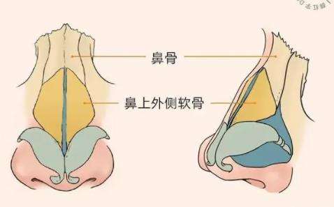 鼻修复 鼻修复