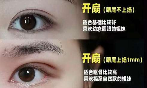 眼整形1.jpg 眼整形1.jpg