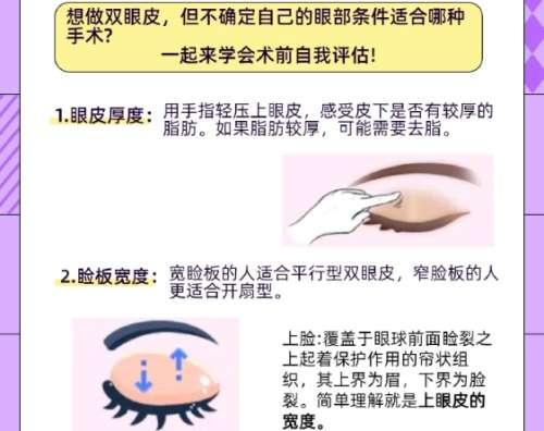 双眼皮