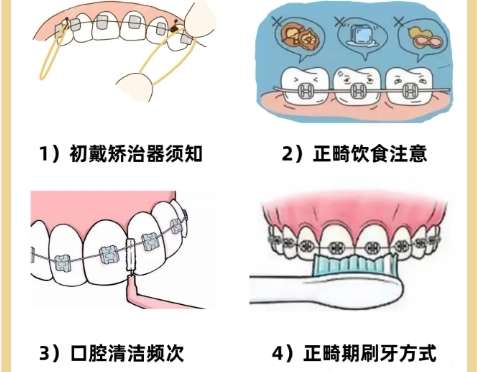 牙齿正畸