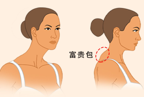 富贵包.png