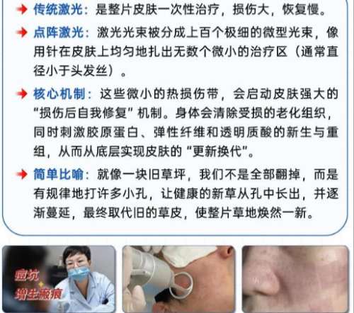 点阵激光6.jpg 点阵激光6.jpg
