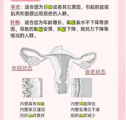 私密