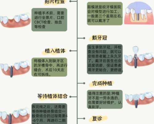牙齿种植