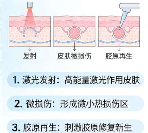 点阵激光5.jpg 点阵激光5.jpg