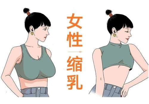 缩胸2.jpg