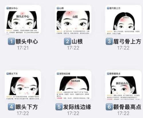 祛痘1.jpg 祛痘1.jpg
