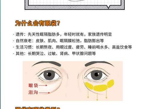 眼袋6.jpg
