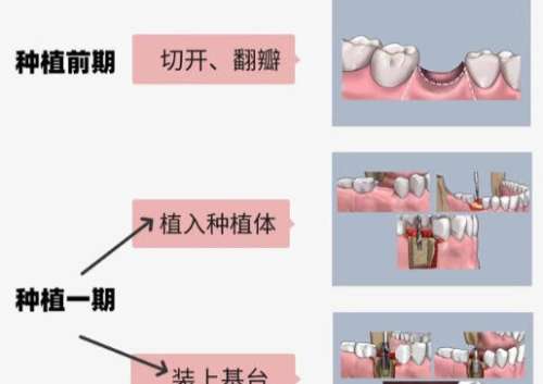 种牙8.jpg