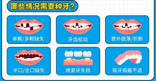 牙齿种植