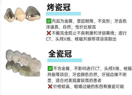 全瓷牙