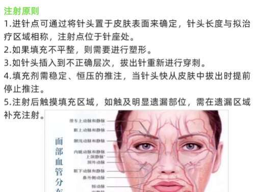 注射美容 注射美容